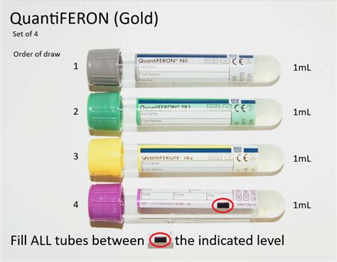 quantiferon tube color|quantiferon order of draw.